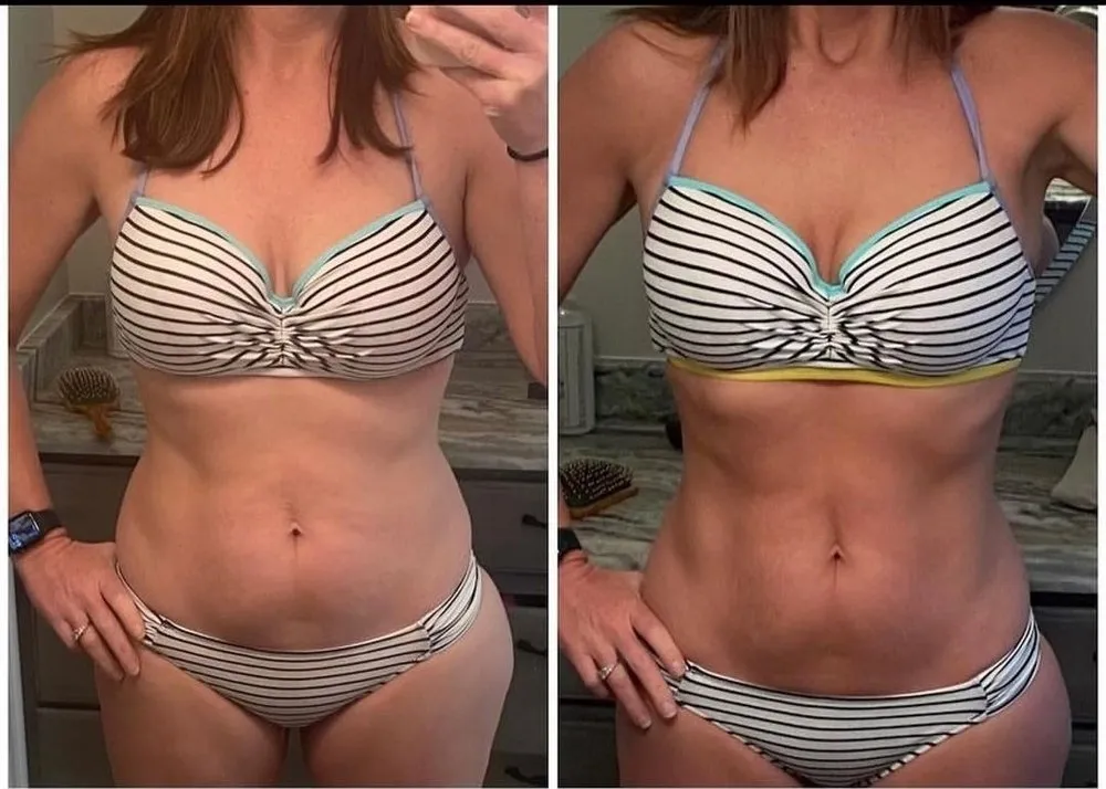 Body Transformation With Hormone Replacement & Emsculpt