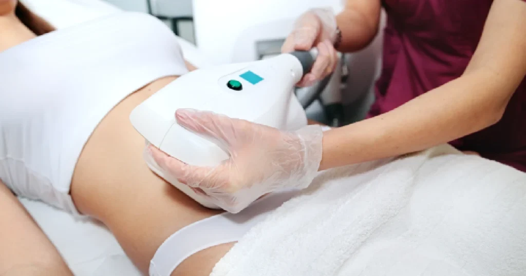 A woman receiving CoolSculpting in Cincinnati, OH
