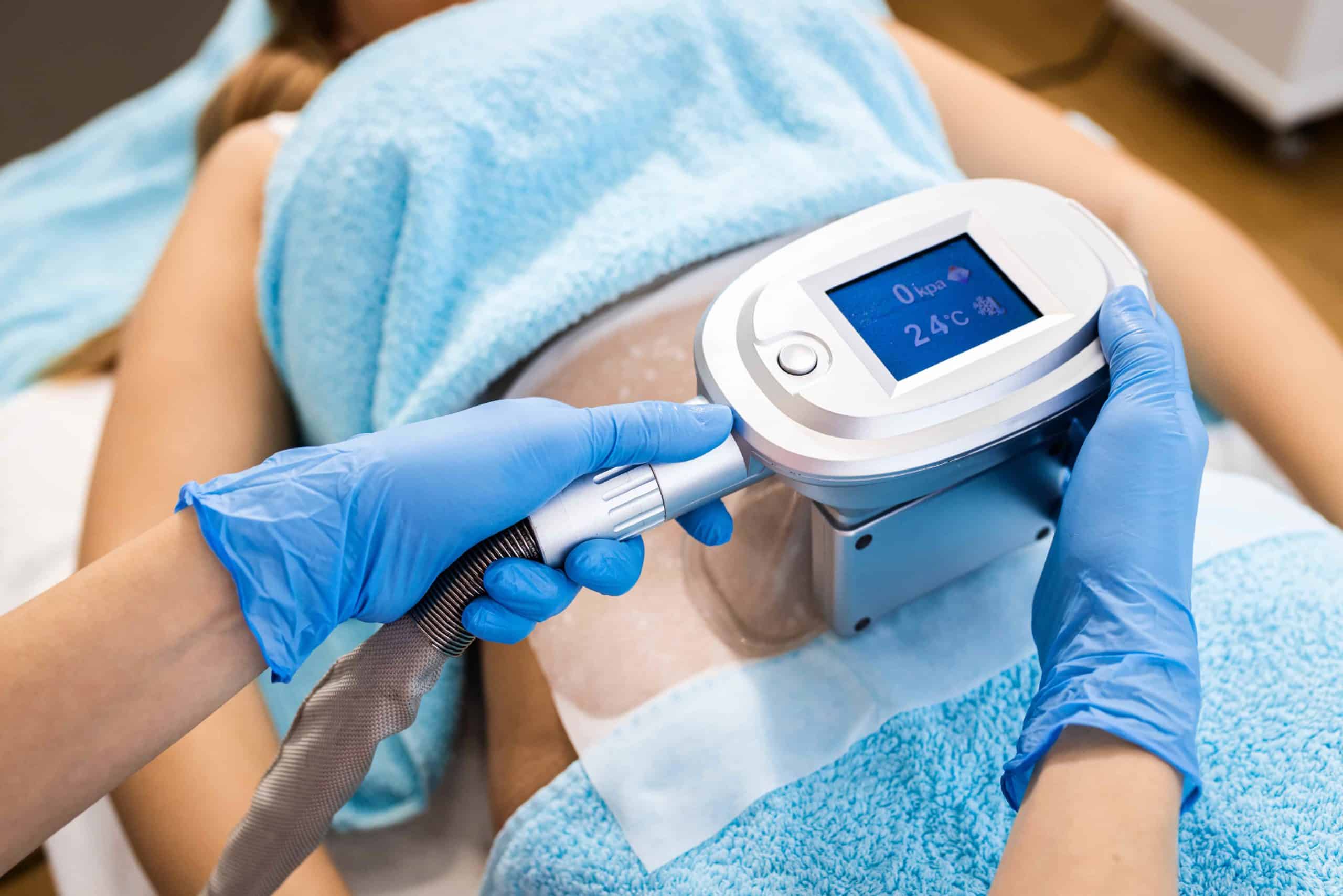 Can CoolSculpting get rid of Belly Fat